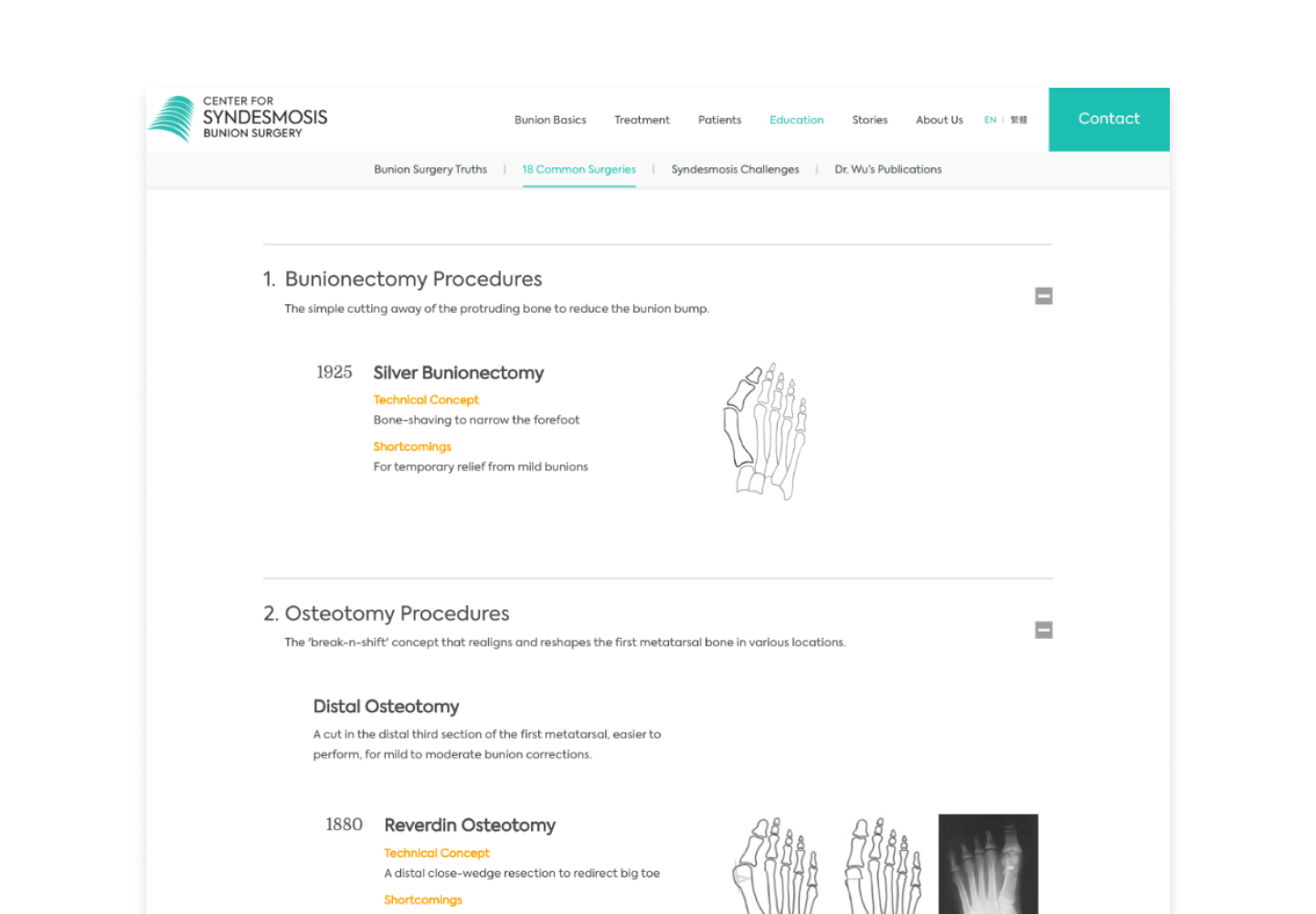 Center for Syndesmosis Bunion Surgery screenshot 3