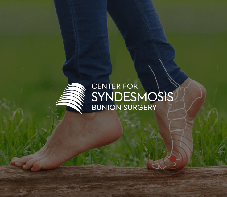 Center for Syndesmosis Bunion Surgery